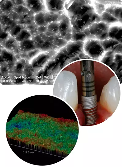 DSP Biomedical produz a mais completa linha de produtos para procedimentos de odontologia, cirurgia bucomaxilofacial e implantodontia do mercado nacional.